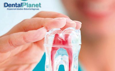 La endodoncia es uno de los tratamientos dentales más habituales en odontología.